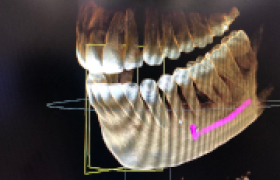 Chirurgiens-Dentistes à Marseille 8ème (13008)